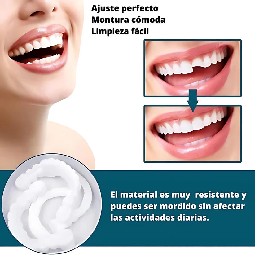 Carillas Dentales Ajustables - Transforma tu sonrisa