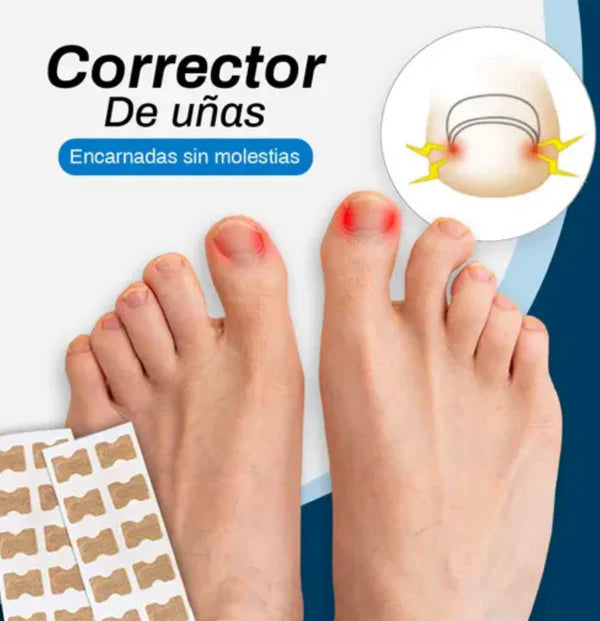 Parche corrector uña encarnada
