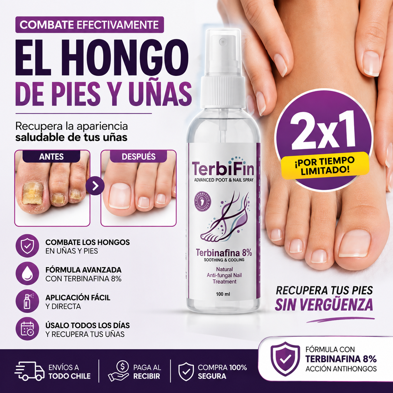 TerbiFin™ Spray Antihongos para Pies y Uñas – ¡2x1 Oferta Especial!
