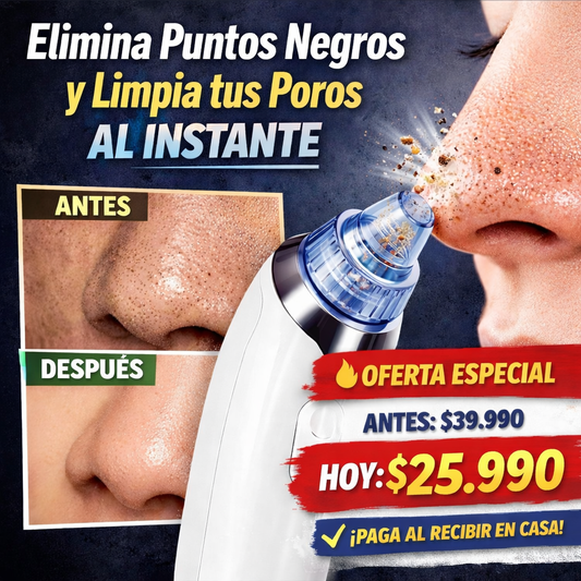 Extractor Eléctrico de Puntos Negros – Limpieza Facial Profunda sin Dolor
