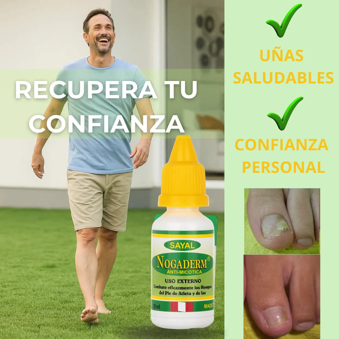 💧 Nogaderm – Gotas Antihongos con Resultados en 7 Días