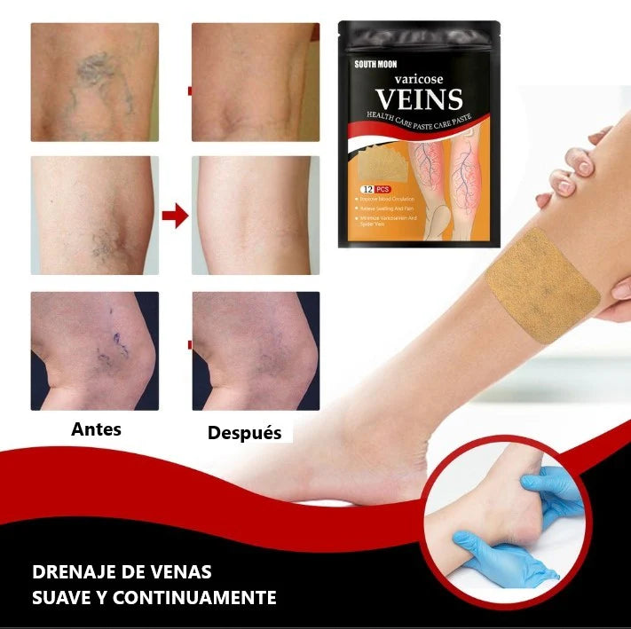 Promo 4x Parches para Varices