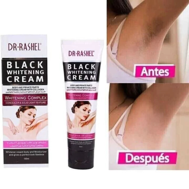 Crema Blanqueadora Corporal